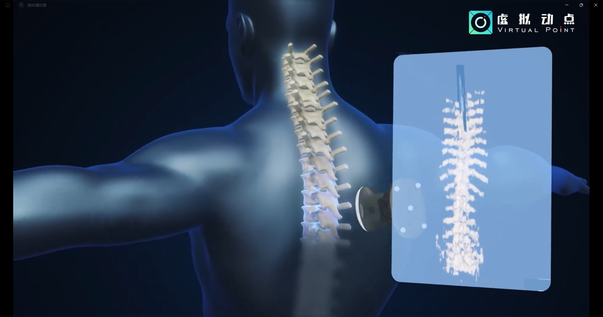 威尼斯9499·虚拟动点OptiTrack开创3D超声成像在脊柱诊断中的应用